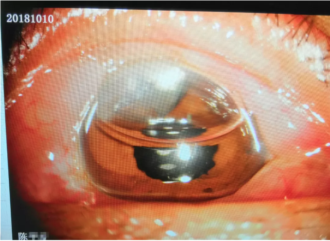 QQ截图20181013095721.png QQ截图20181013095721.png